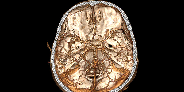 3. ����� ��������. 