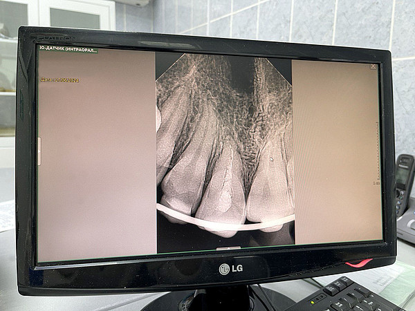 ����� �����3. 