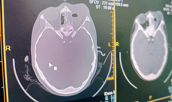 IMG_20240829_072138. 