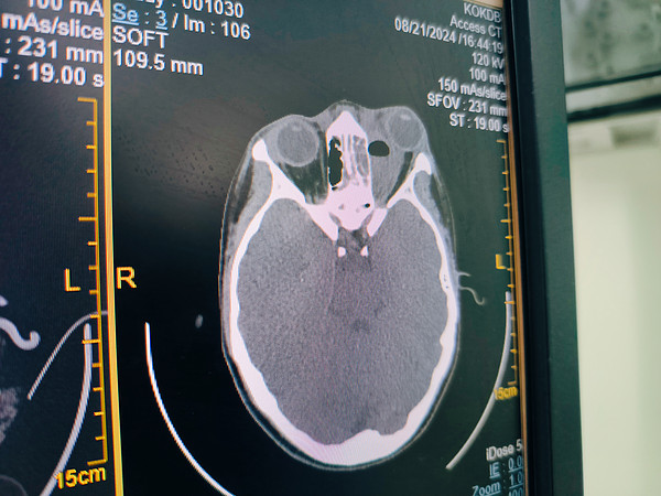 IMG_20240829_072153. 