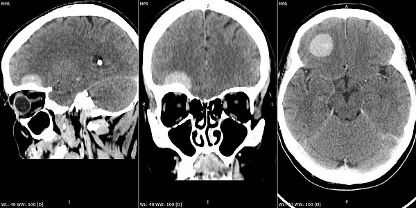 ���������. 